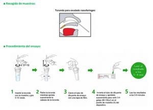 Prueba rápida de antígeno de SARS-CoV-2 Biocredit – Pack 20 test