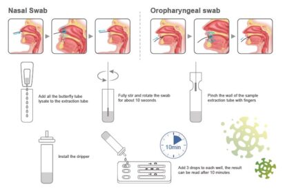 Test combinado Synthgene SARS-CoV-2 + Flu A + Flu B + RSV
